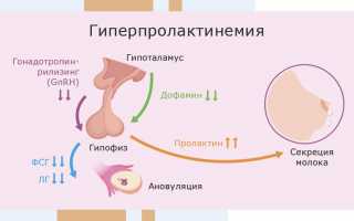 Причины отсутствия овуляции
