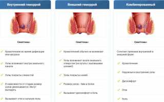 Симптомы хронического геморроя