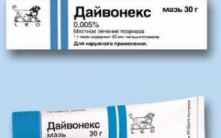 Какие мази помогают от псориаза на голове