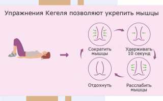 Послеродовое недержание мочи