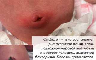 Что делать после того, как у новорожденного отпал пупок