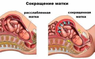 Тонус матки во втором триместре беременности