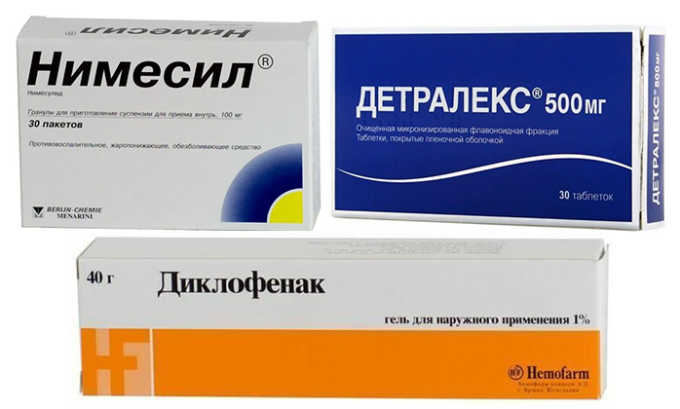 Таблетки (Диклофенак, Нимесил, Детралекс). Используются для устранения воспаления и нормализации состояния сосудов