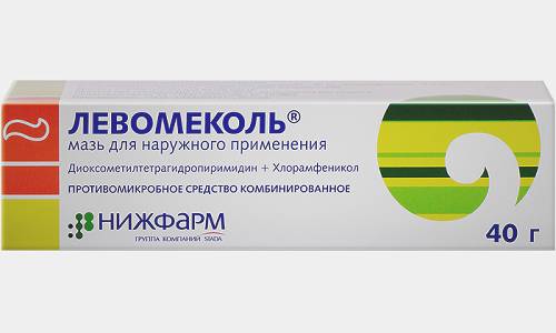 После обработки всех узлов анус тампонируют, используя Левомеколь для предупреждения кровотечения