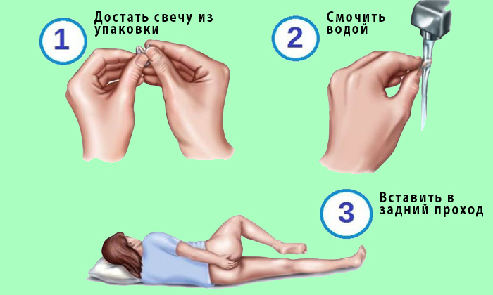 Начальные проявления заболевания можно лечить дома самостоятельно