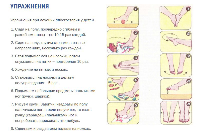 Профилактика детского плоскостопия и его лечение